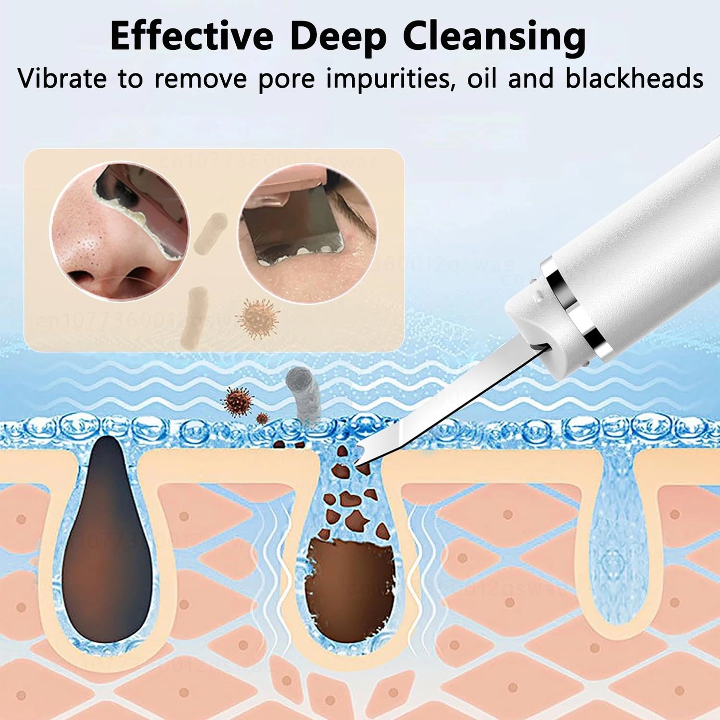 Ultrasonic Blackhead Remover